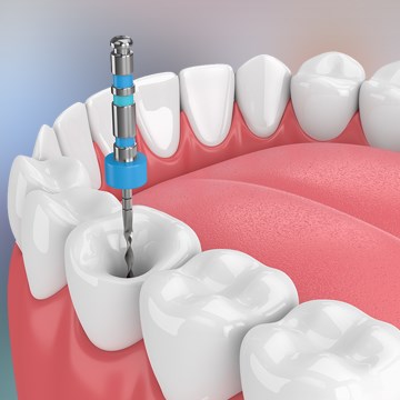 Endodontics